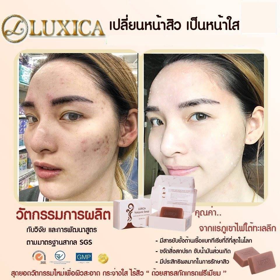 สบู่ลูซิก้า โวลคานิค สบู่ลดสิวที่สกัดจากแร่ภูเขาไฟ