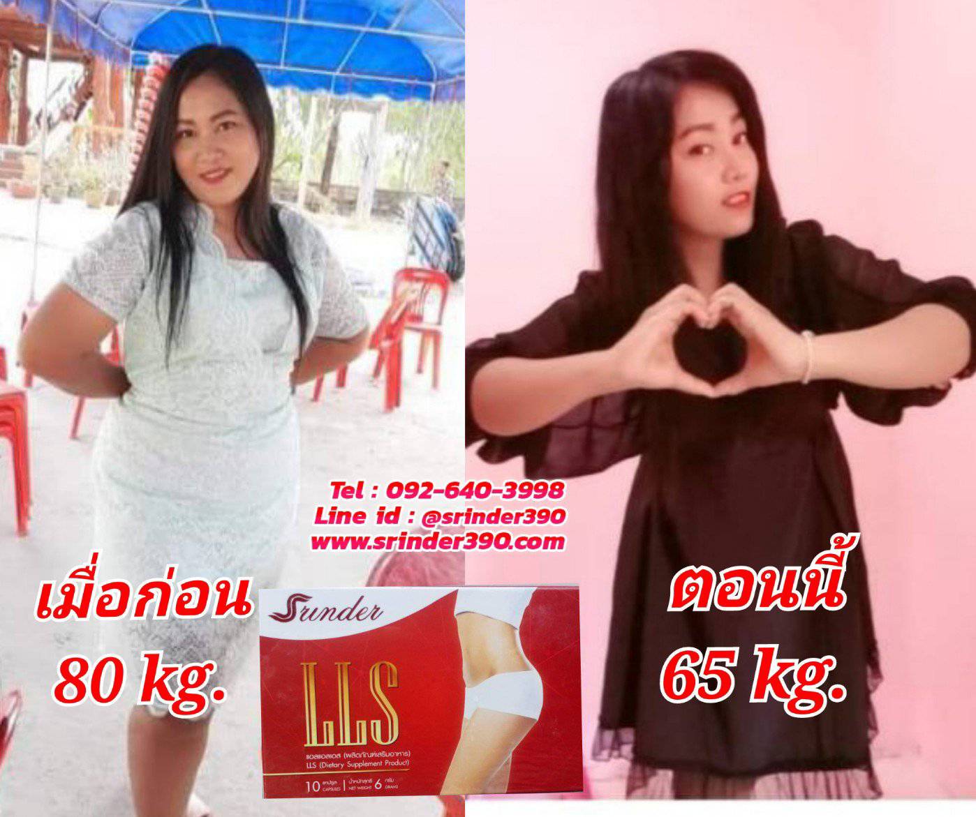 Srinder LLS อาหารเสริมลดน้ำหนัก สรินเดอร์ (1-6กล่อง)