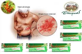 ยาครีมพญายอ อภัยภูเบศร