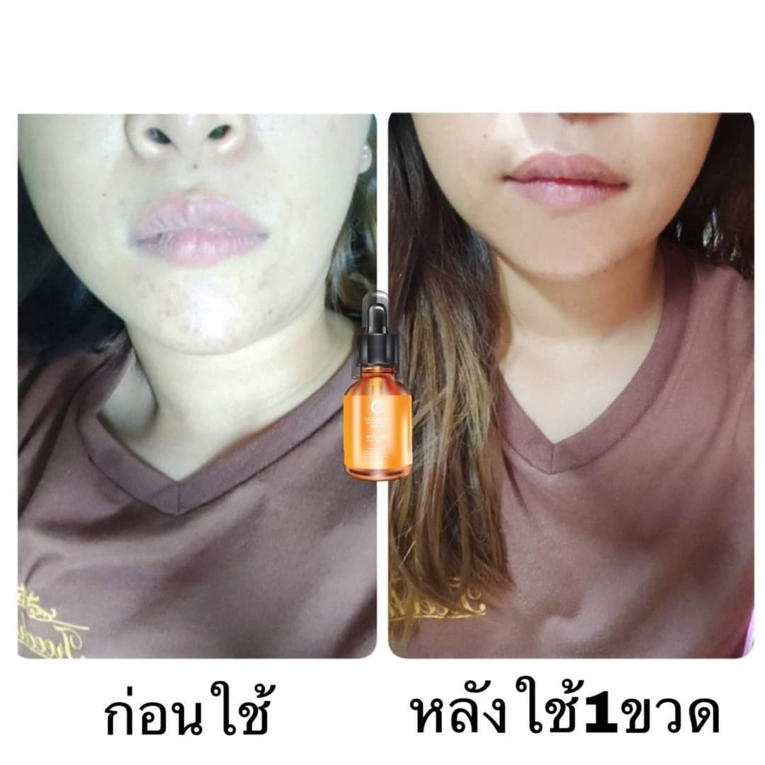 วิตซีเซรั่ม (VIT C Serum) เผยผิวสวยกระจ่างใส ใช้ได้กับทุกสภาพผิวบำรุงผิวสวยได้ทุกวัน