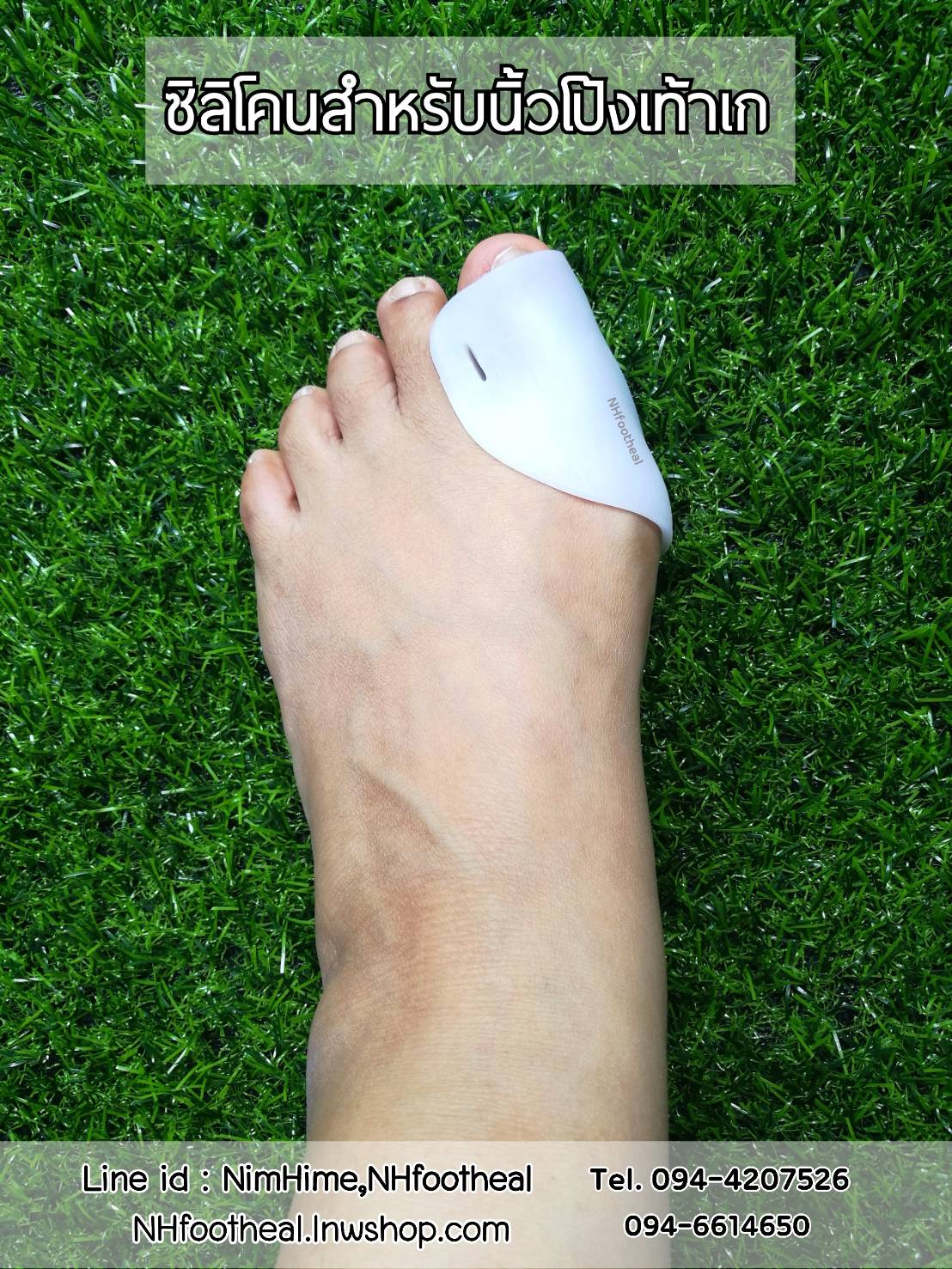 แบบที่14 ซิลิโคนสำหรับนิ้วโป้งเท้าเก (Hallux Valgus)