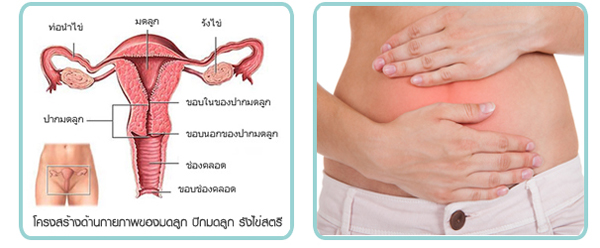 มะเร็งปากมดลูก