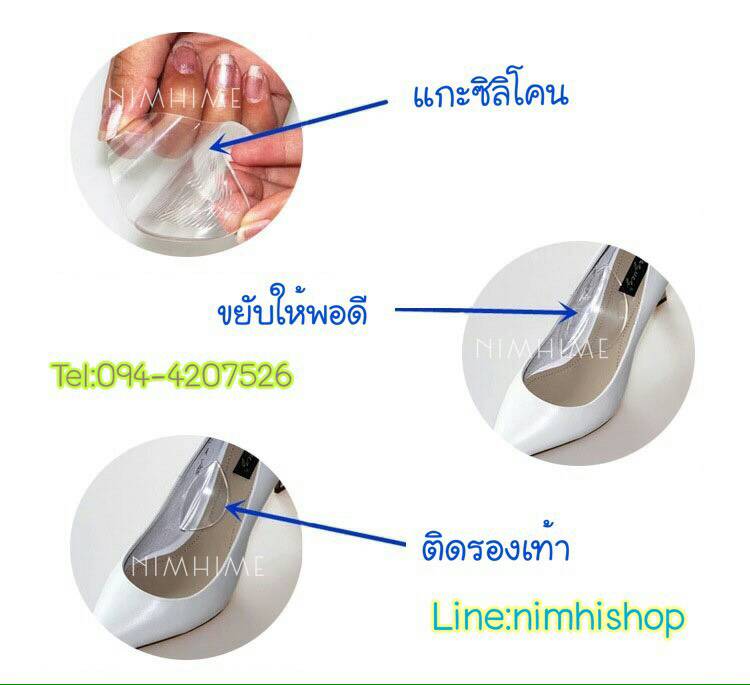 ซิลิโคนก้อนหนุนซัพพอต อุ้งเท้า สำหรับผู้มีปัญหาเท้าแบน