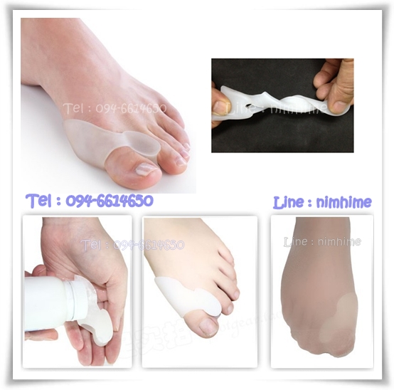แบบที่1 ซิลิโคนสำหรับนิ้วโป้งเท้าเก (Hallux Valgus)