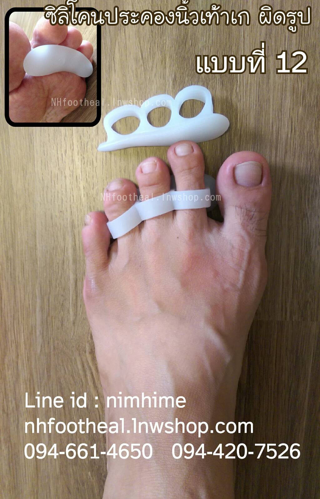 แบบที่12 ซิลิโคนซัพพอตนิ้วเท้า (Hallux Valgus)