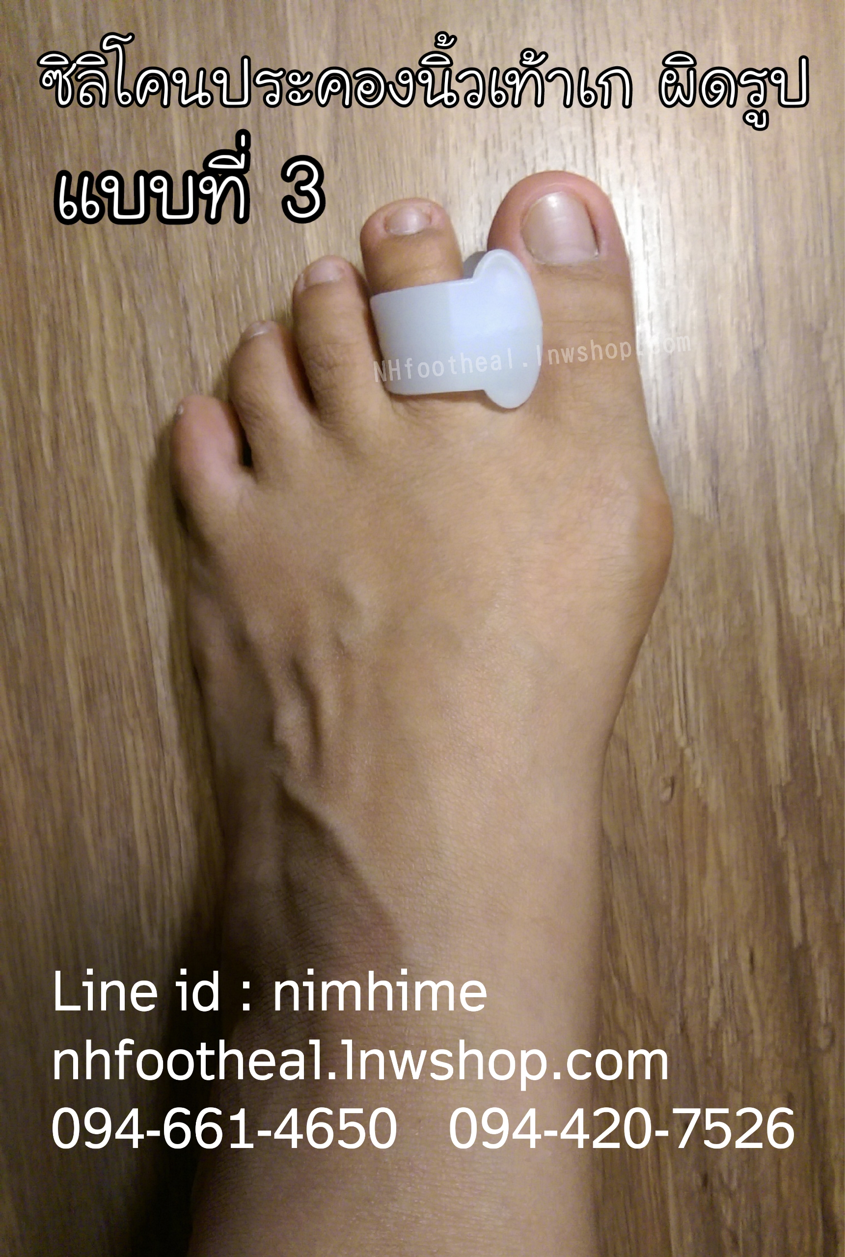 แบบที่3 ซิลิโคนสำหรับนิ้วโป้งเท้า (Hallux Valgus)