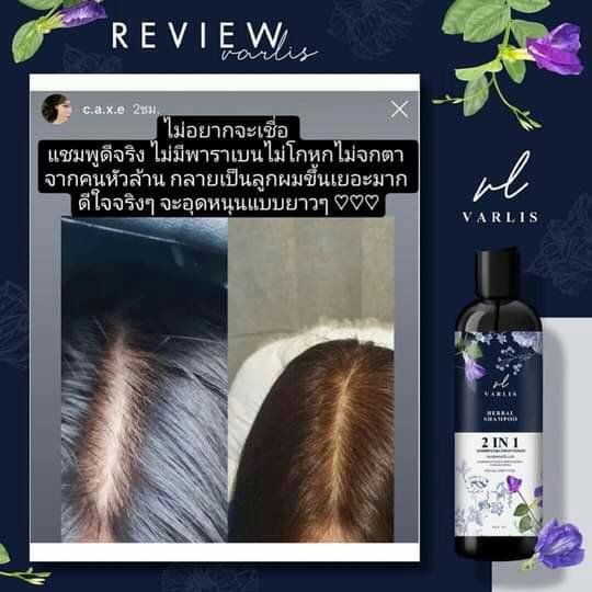 แชมพู Varlis ขจัดทุกปัญหาเส้นผม ลดผมร่วง เร่งผมยาว สำหรับทุกสภาพผม