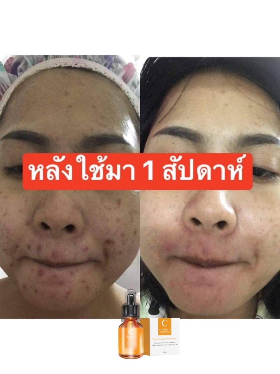 วิตซีเซรั่ม (VIT C Serum) เผยผิวสวยกระจ่างใส ใช้ได้กับทุกสภาพผิวบำรุงผิวสวยได้ทุกวัน