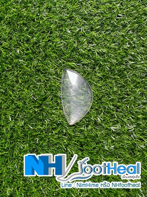 ซิลิโคนก้อนหนุนซัพพอต อุ้งเท้า สำหรับผู้มีปัญหาเท้าแบน