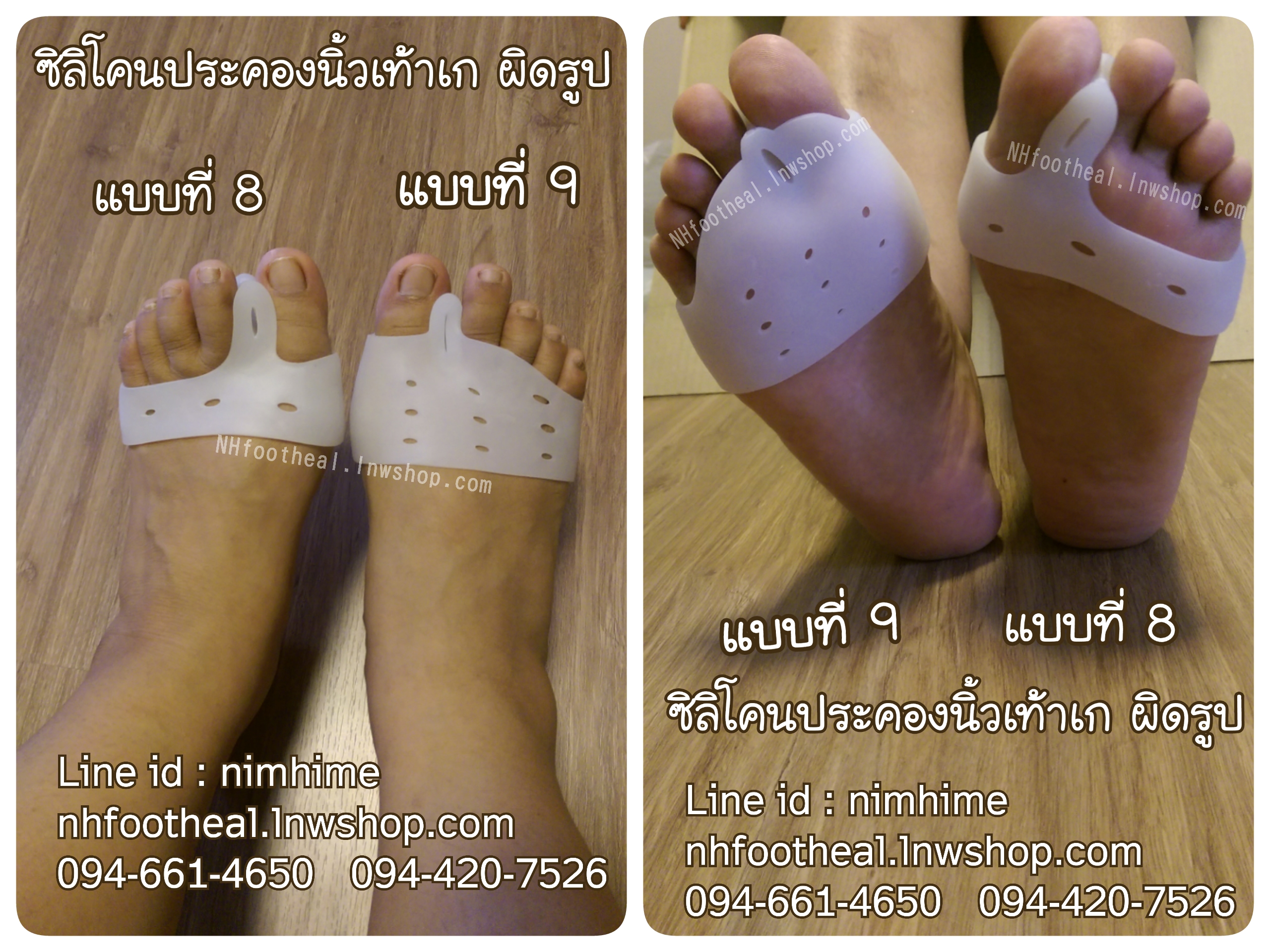 แบบที่9 ซิลิโคนสำหรับนิ้วโป้งเท้าเก (Hallux Valgus)