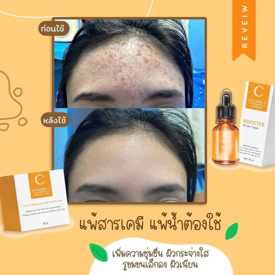 วิตซีเซรั่ม (VIT C Serum) เผยผิวสวยกระจ่างใส ใช้ได้กับทุกสภาพผิวบำรุงผิวสวยได้ทุกวัน