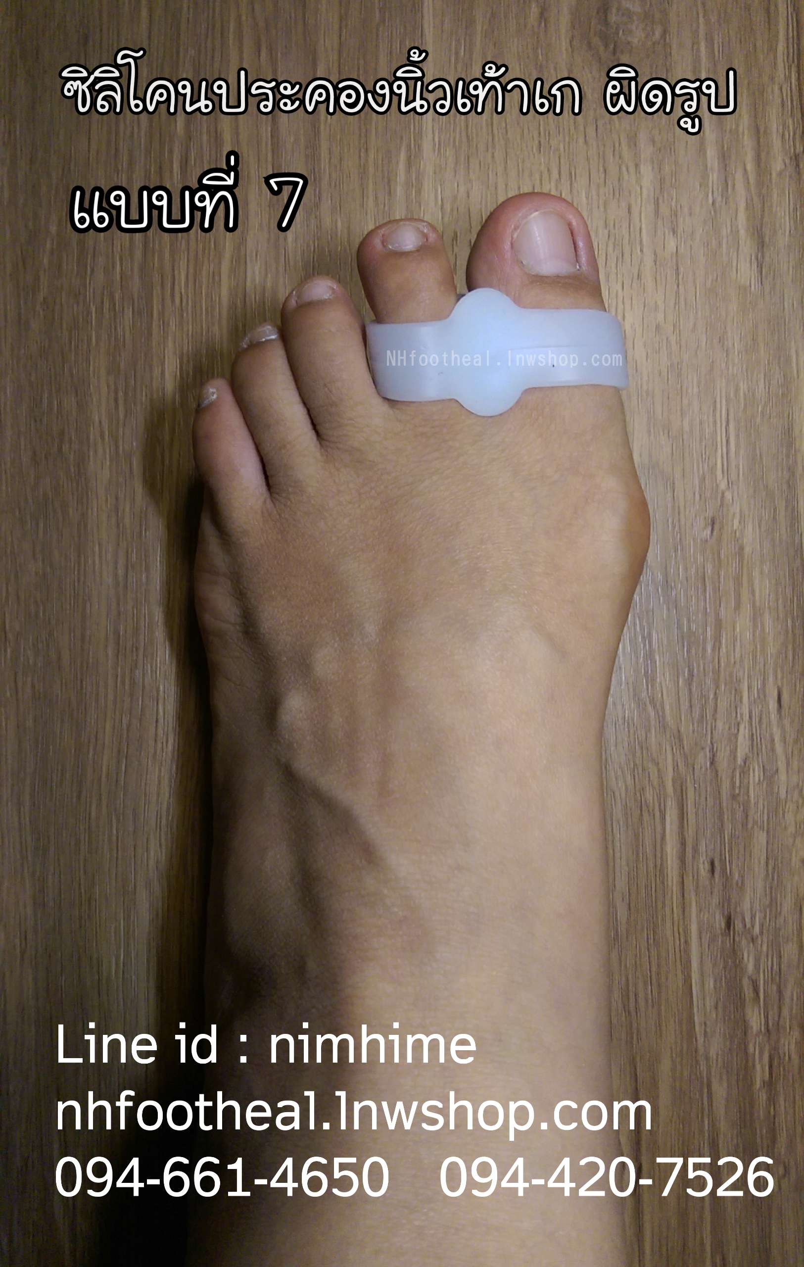 แบบที่7 ซิลิโคนสำหรับนิ้วโป้งเท้าเก ชิด (Hallux Valgus)