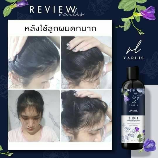 แชมพู Varlis ขจัดทุกปัญหาเส้นผม ลดผมร่วง เร่งผมยาว สำหรับทุกสภาพผม