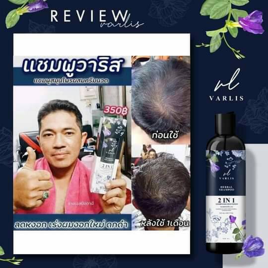 แชมพู Varlis ขจัดทุกปัญหาเส้นผม ลดผมร่วง เร่งผมยาว สำหรับทุกสภาพผม