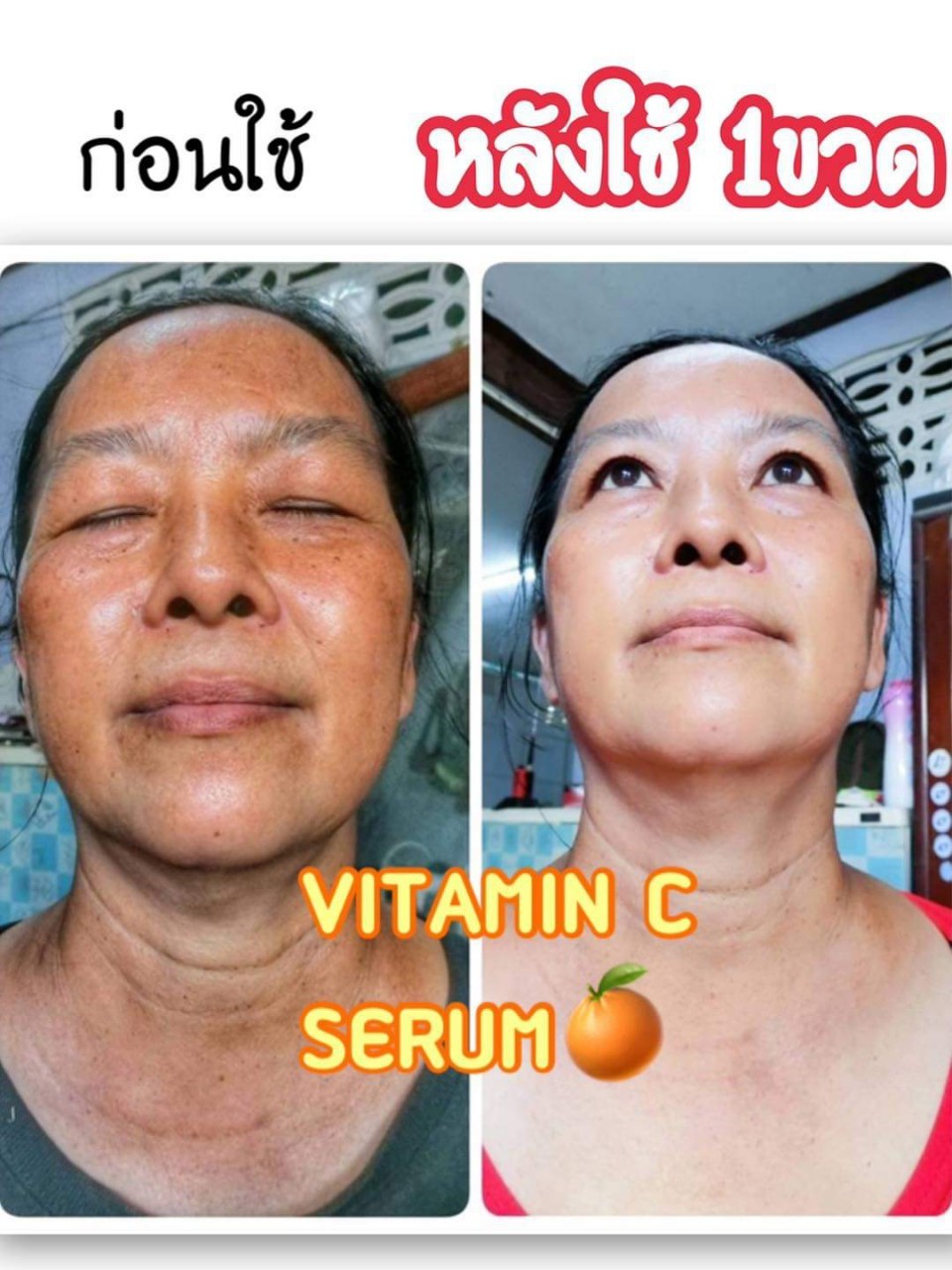 วิตซีเซรั่ม (VIT C Serum) เผยผิวสวยกระจ่างใส ใช้ได้กับทุกสภาพผิวบำรุงผิวสวยได้ทุกวัน