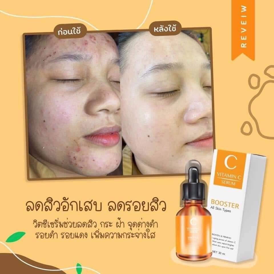 วิตซีเซรั่ม (VIT C Serum) เผยผิวสวยกระจ่างใส ใช้ได้กับทุกสภาพผิวบำรุงผิวสวยได้ทุกวัน