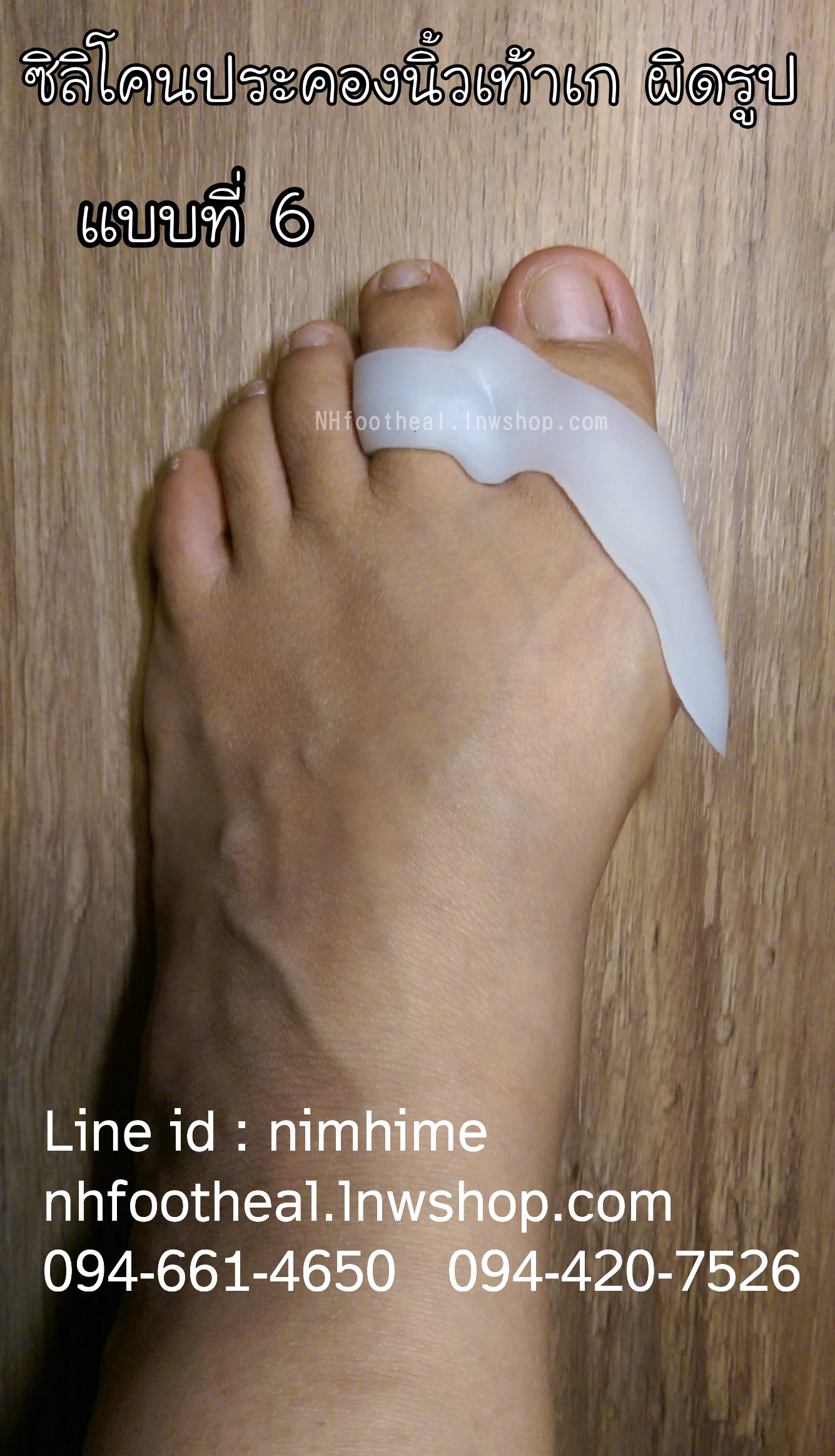แบบที่6 ซิลิโคนสำหรับนิ้วโป้งเท้าเก (Hallux Valgus)