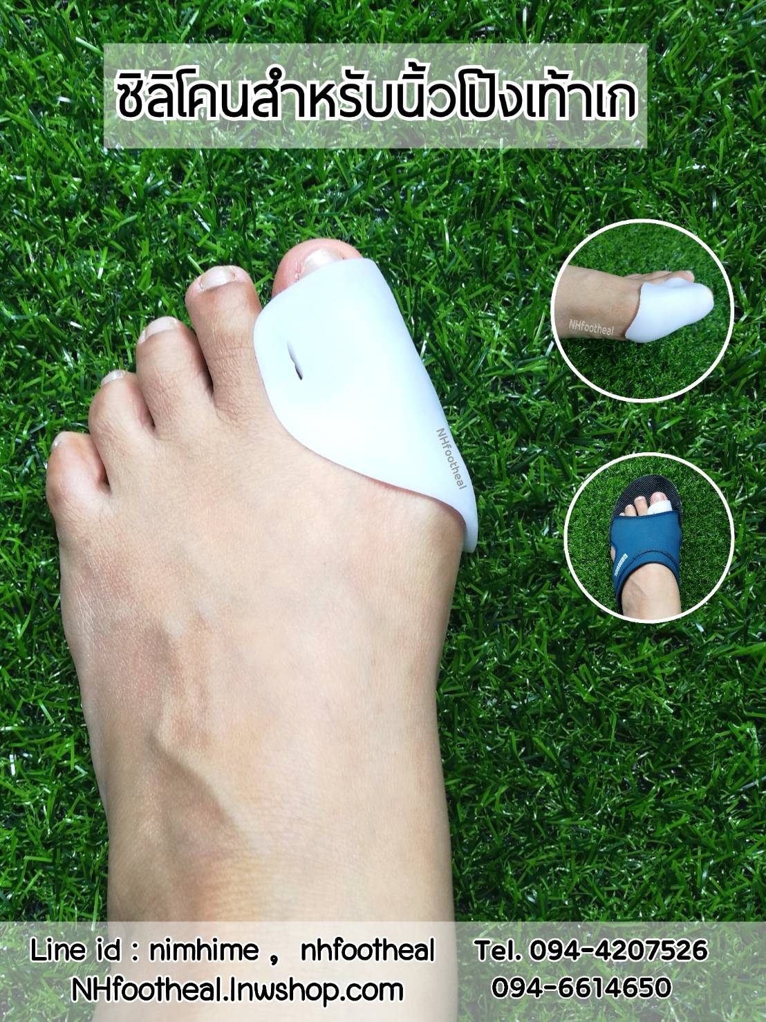 แบบที่14 ซิลิโคนสำหรับนิ้วโป้งเท้าเก (Hallux Valgus)