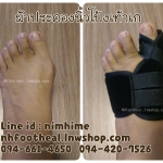 แบบที่4 ไซส์ S อุปกรณ์ดูแลนิ้วโป้งเท้าเก ภาวะนิ้วโป้งเท้าเก (Hallux Valgus)