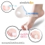 แบบที่3 ซิลิโคนสำหรับนิ้วโป้งเท้า (Hallux Valgus)