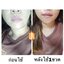 วิตซีเซรั่ม (VIT C Serum) เผยผิวสวยกระจ่างใส ใช้ได้กับทุกสภาพผิวบำรุงผิวสวยได้ทุกวัน