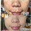 วิตซีเซรั่ม (VIT C Serum) เผยผิวสวยกระจ่างใส ใช้ได้กับทุกสภาพผิวบำรุงผิวสวยได้ทุกวัน