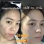 วิตซีเซรั่ม (VIT C Serum) เผยผิวสวยกระจ่างใส ใช้ได้กับทุกสภาพผิวบำรุงผิวสวยได้ทุกวัน