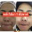 วิตซีเซรั่ม (VIT C Serum) เผยผิวสวยกระจ่างใส ใช้ได้กับทุกสภาพผิวบำรุงผิวสวยได้ทุกวัน