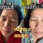 วิตซีเซรั่ม (VIT C Serum) เผยผิวสวยกระจ่างใส ใช้ได้กับทุกสภาพผิวบำรุงผิวสวยได้ทุกวัน