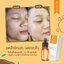 วิตซีเซรั่ม (VIT C Serum) เผยผิวสวยกระจ่างใส ใช้ได้กับทุกสภาพผิวบำรุงผิวสวยได้ทุกวัน