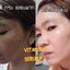 วิตซีเซรั่ม (VIT C Serum) เผยผิวสวยกระจ่างใส ใช้ได้กับทุกสภาพผิวบำรุงผิวสวยได้ทุกวัน