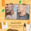 วิตซีเซรั่ม (VIT C Serum) เผยผิวสวยกระจ่างใส ใช้ได้กับทุกสภาพผิวบำรุงผิวสวยได้ทุกวัน